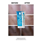 Effaclar Duo+M: Anti-Blemish Corrective Gel Moisturiser