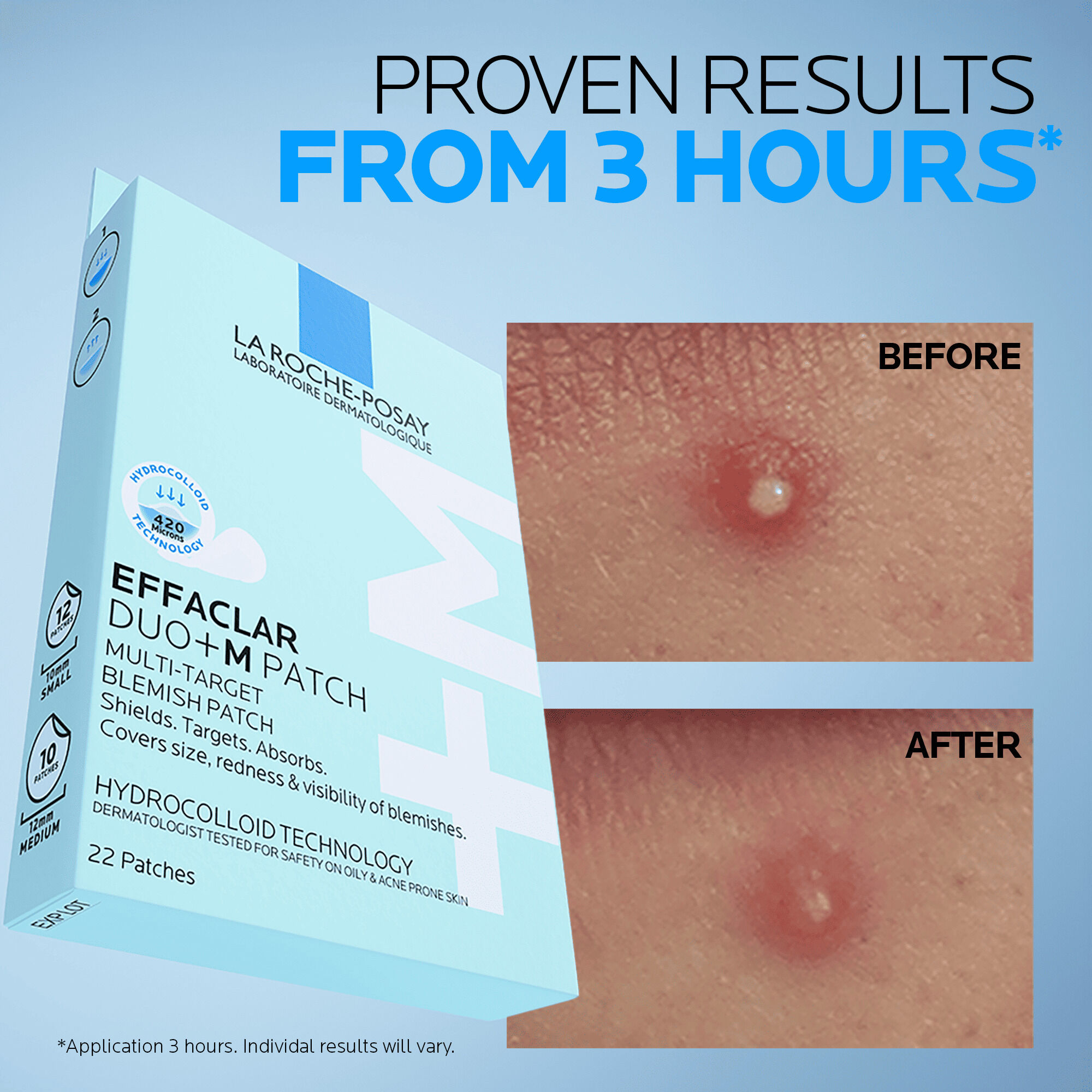 Effaclar Duo+M 3H Spot Patches