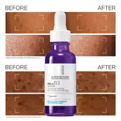 Mela B3 Intense Anti-dark spot serum