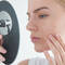 acne round mouth