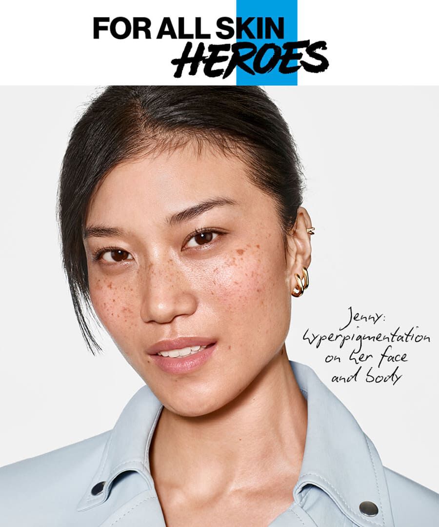 Jenny, has hyperpigmentation on her face and body