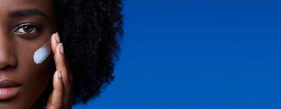 Close up of a woman’s face with visible areas of hyperpigmentation with increased melanin in her skin.