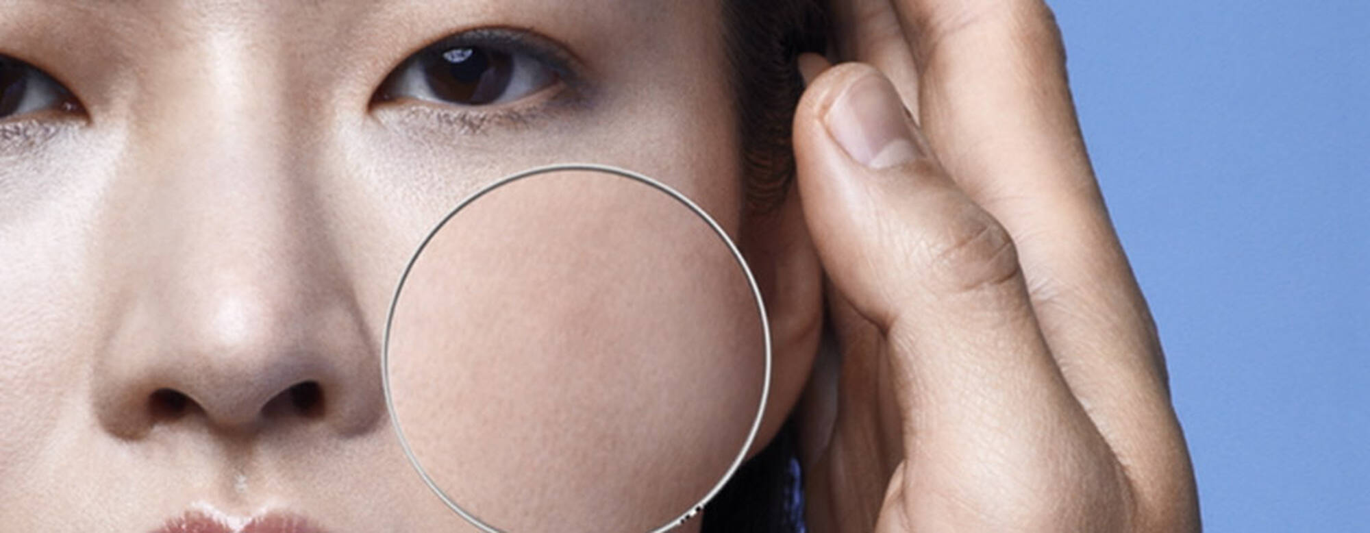 A close-up shot of imperfections on skin, showing the effects of a retinol purge.