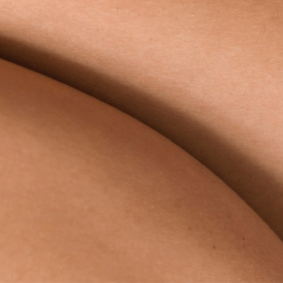 Soothe Your Skin During Treatment