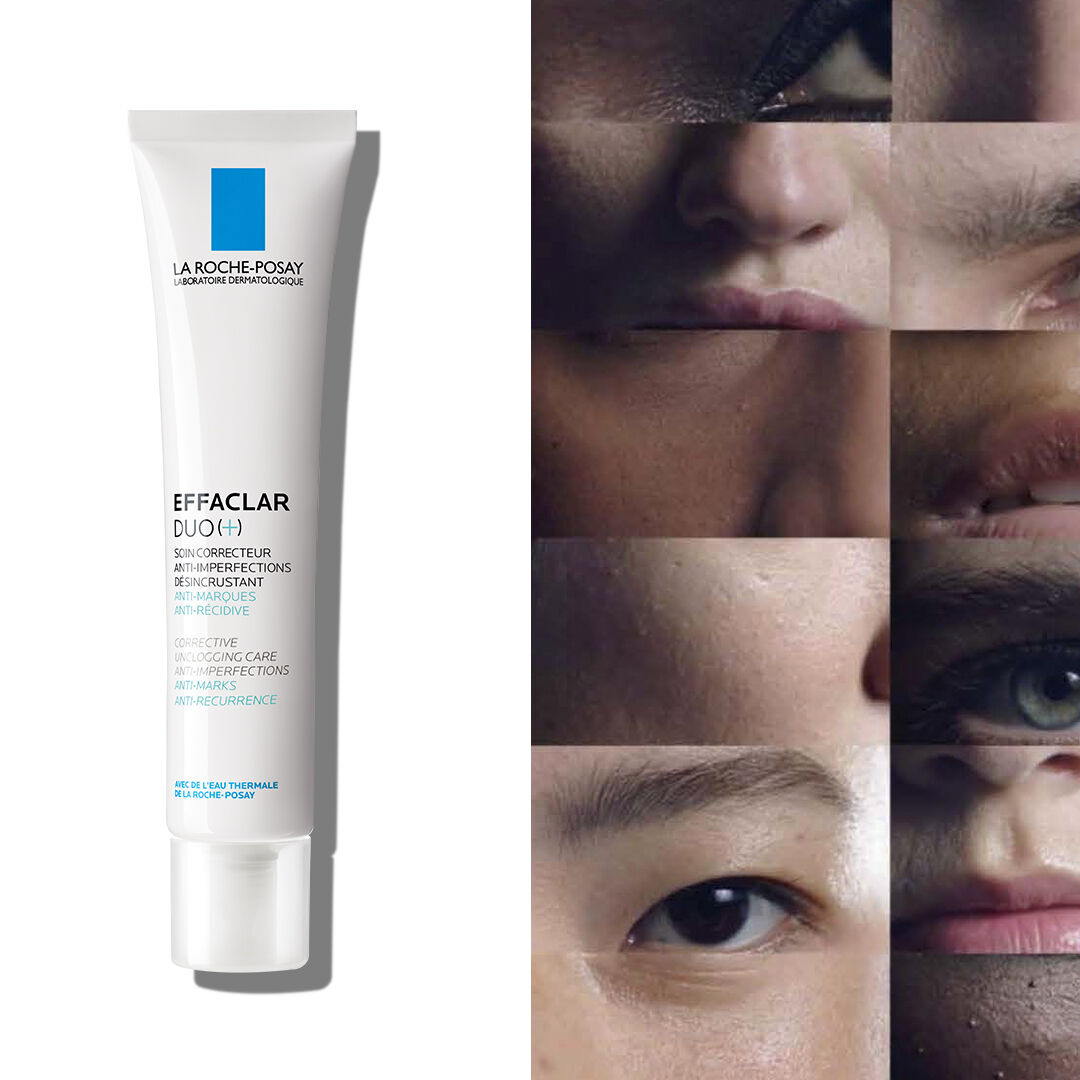 Closed comedones Causes and treatment La Roche Posay