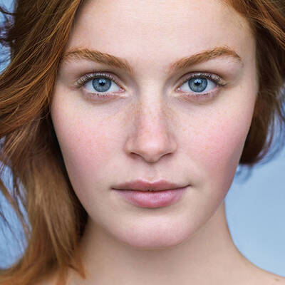 facial redness and inflammation