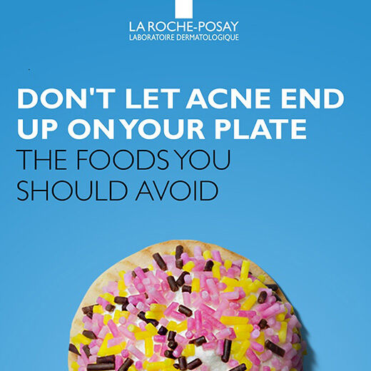 Text on a blue background that reads, "Don't let acne end up on your plate. The foods you should avoid."