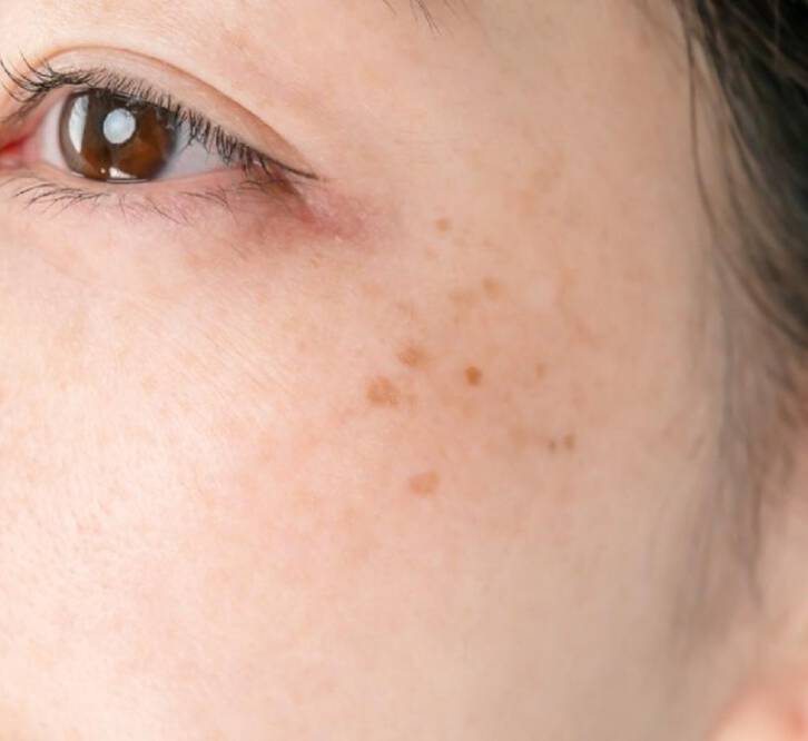 Consultant Dermatologist Dr Emma Craythorne holding a SkinCeuticals vitamin C serum”.