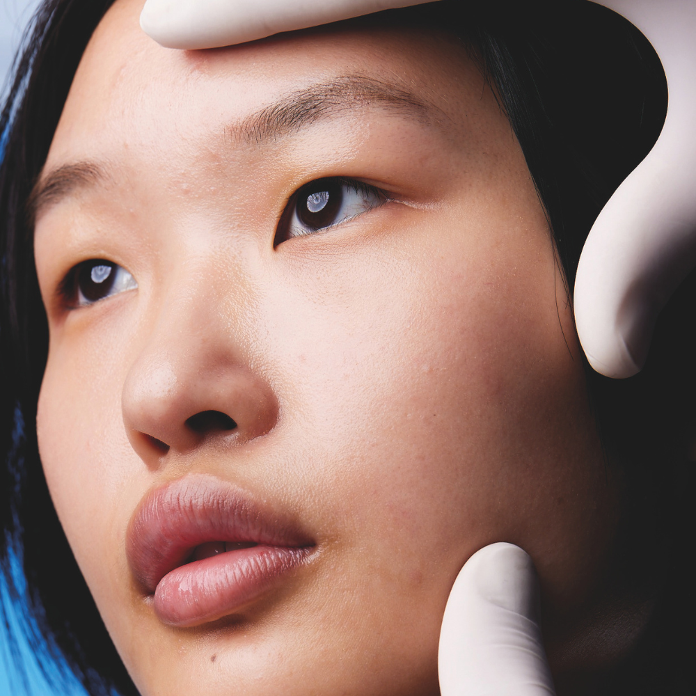 A dermatologist resting their hands on a woman’s face with blemishes